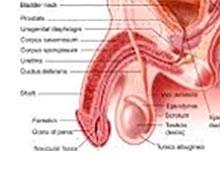 Síndrome da Bexiga Dolorosa ou Cistite Intersticial